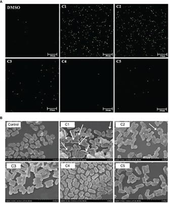 Coumarin derivatives ameliorate the intestinal inflammation and pathogenic gut microbiome changes in the model of infectious colitis through antibacterial activity